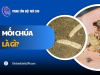 Mối chúa là gì? Vai trò đặc điểm và cách TIÊU DIỆT