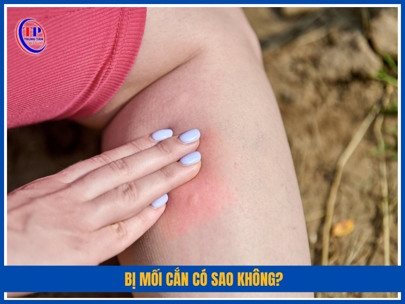 Bị mối cắn có sao không?