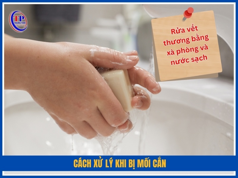 Cách xử lý khi bị mối cắn