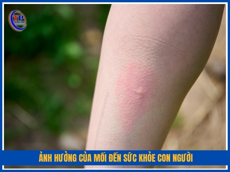 Ảnh hưởng của mối đến sức khỏe con người